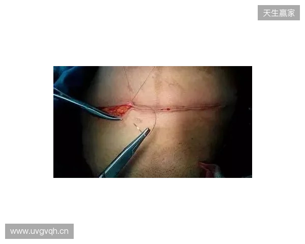 广州豹官方:杨浩眉弓伤口缝合30余针,预计5-7天后拆线 广州豹官方:杨浩眉弓伤口缝合30余针,预计5-7天后拆线